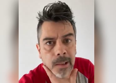 Carlos Espejel “Chiquidracula” sufre parálisis facial ¿cuál es su estado de salud?